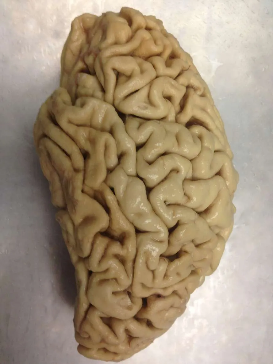 Conference: The human brain: How is it built?